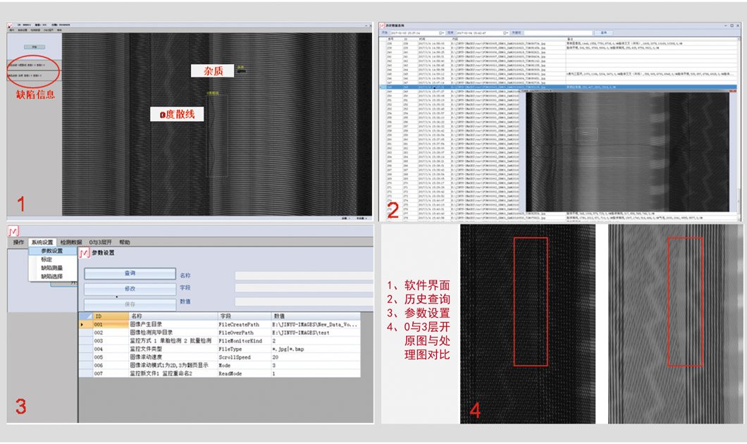 X光自動輔助判級軟件